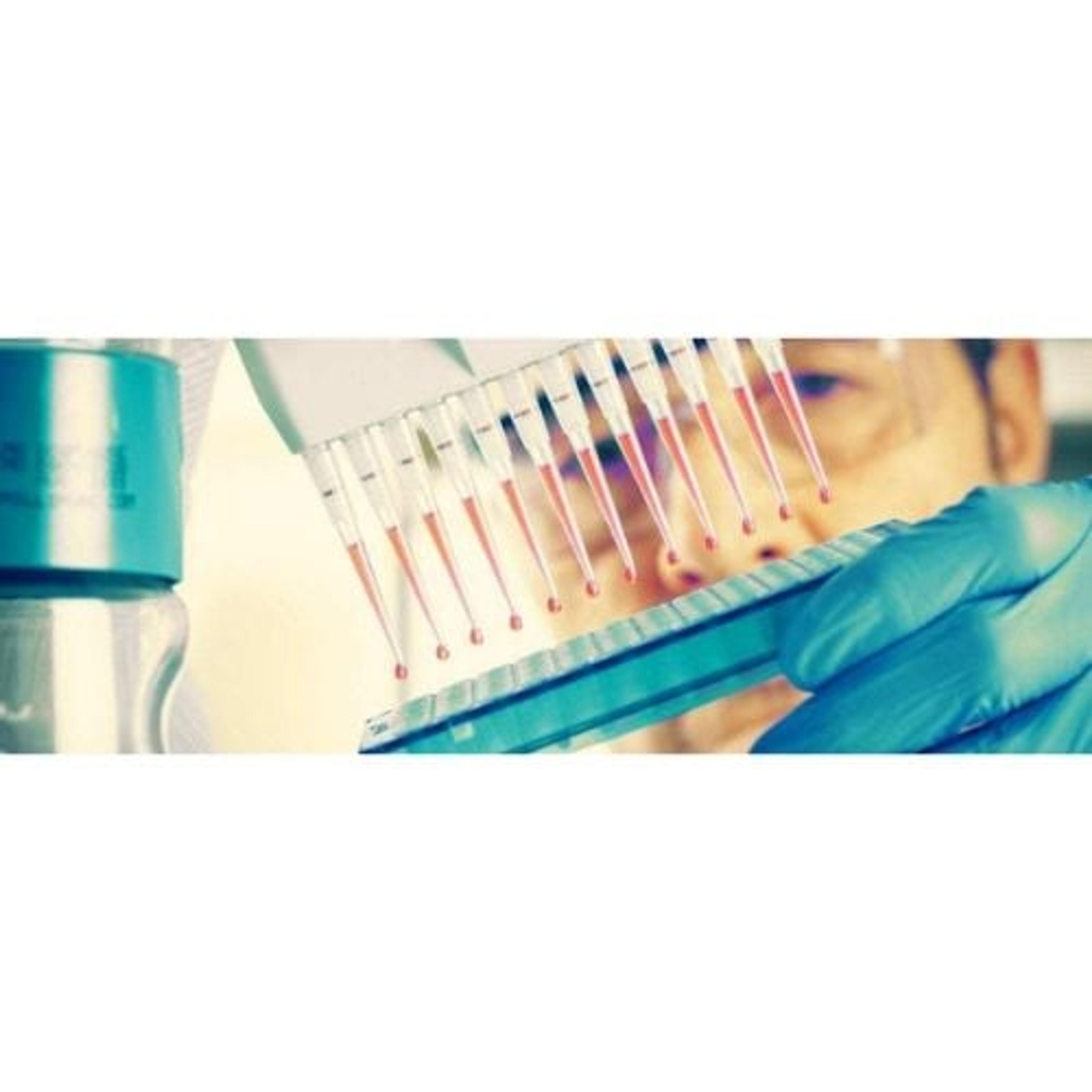 NEUROLOGY 4-PLEX E (Aβ40, Aβ42, GFAP*, Nf-L) - Quanterix - Life Sciences