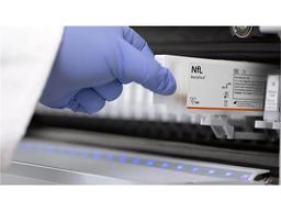 Neurofilament Light Chain (NfL) assay - Siemens Healthineers - Clinical Diagnostics