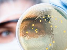 Microbiology - ZeptoMetrix - Analytical Reference Materials - Environmental