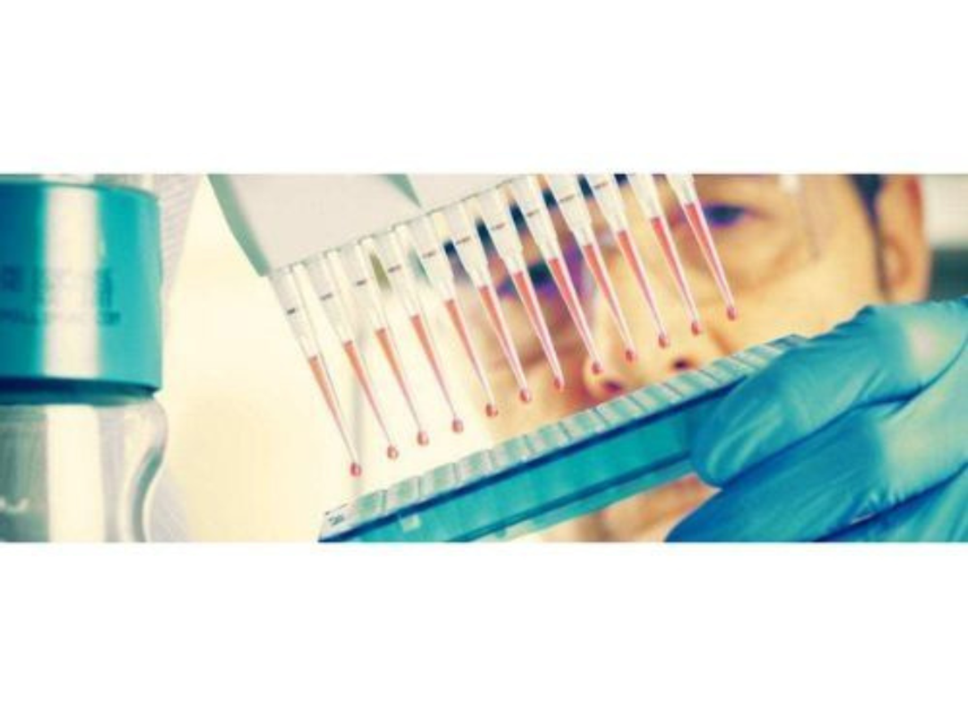 pTau-217 Assay - Quanterix - Life Sciences