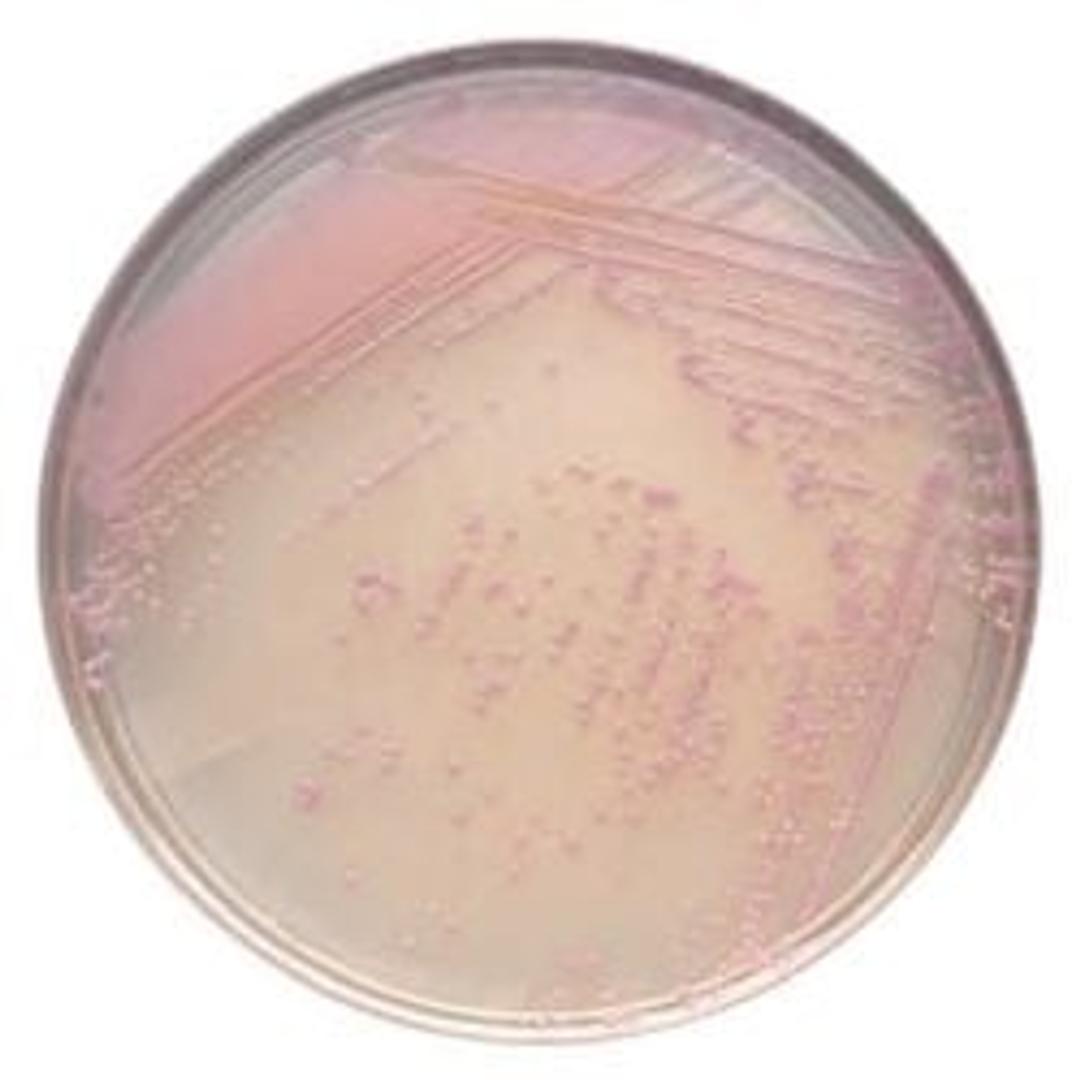 BD BBL™ CHROMagar™ Staph aureus Plate