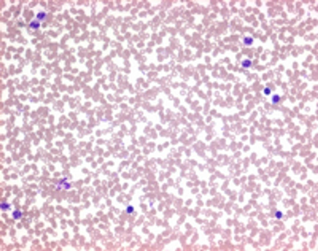 Auto-Hemacolor® - Merck KGaA, Darmstadt, Germany - Clinical Diagnostics