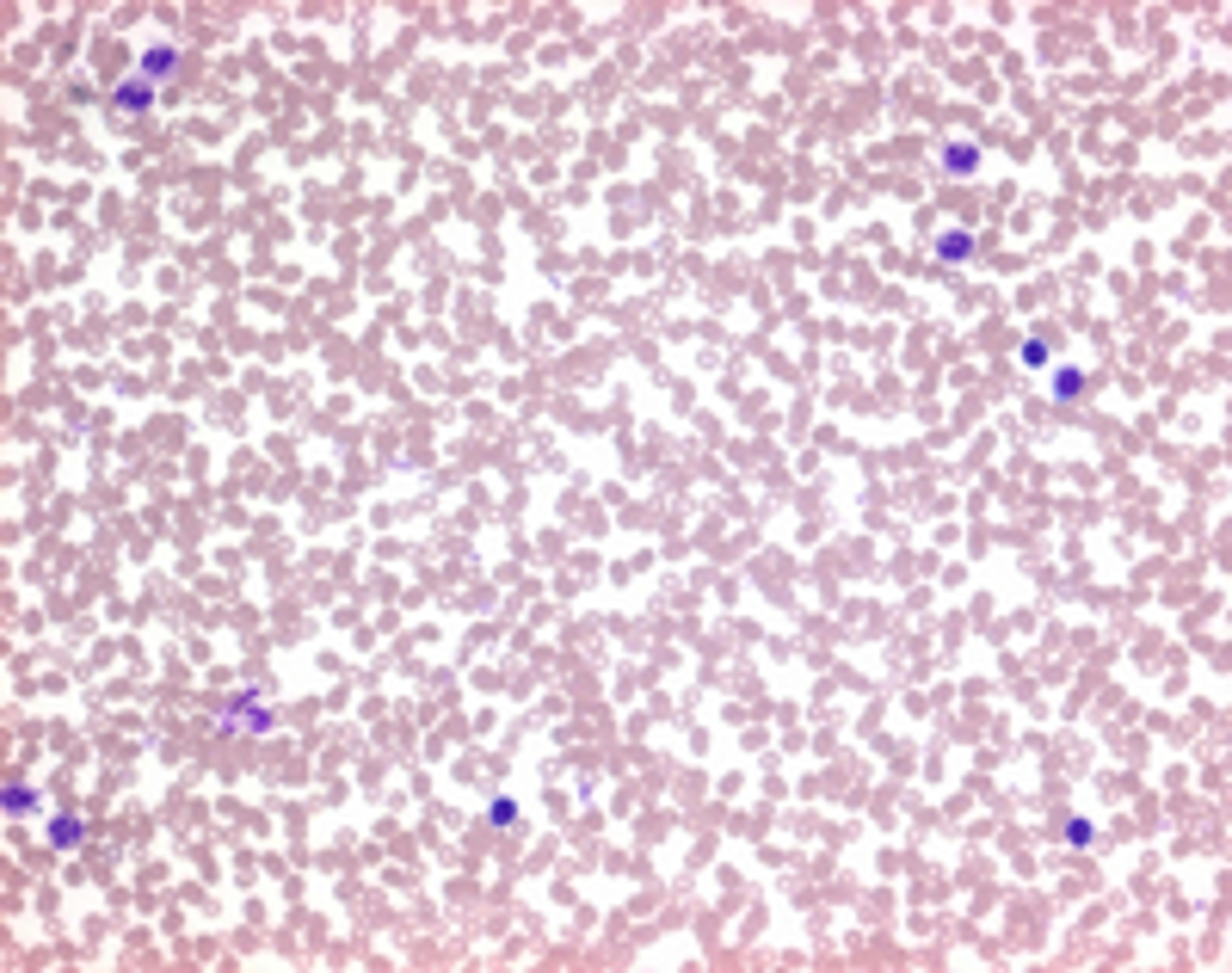 Auto-Hemacolor® - Merck KGaA, Darmstadt, Germany - Clinical Diagnostics