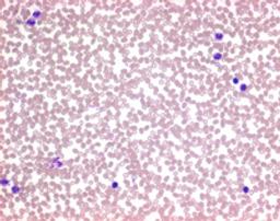 Auto-Hemacolor® - Merck KGaA, Darmstadt, Germany - Clinical Diagnostics