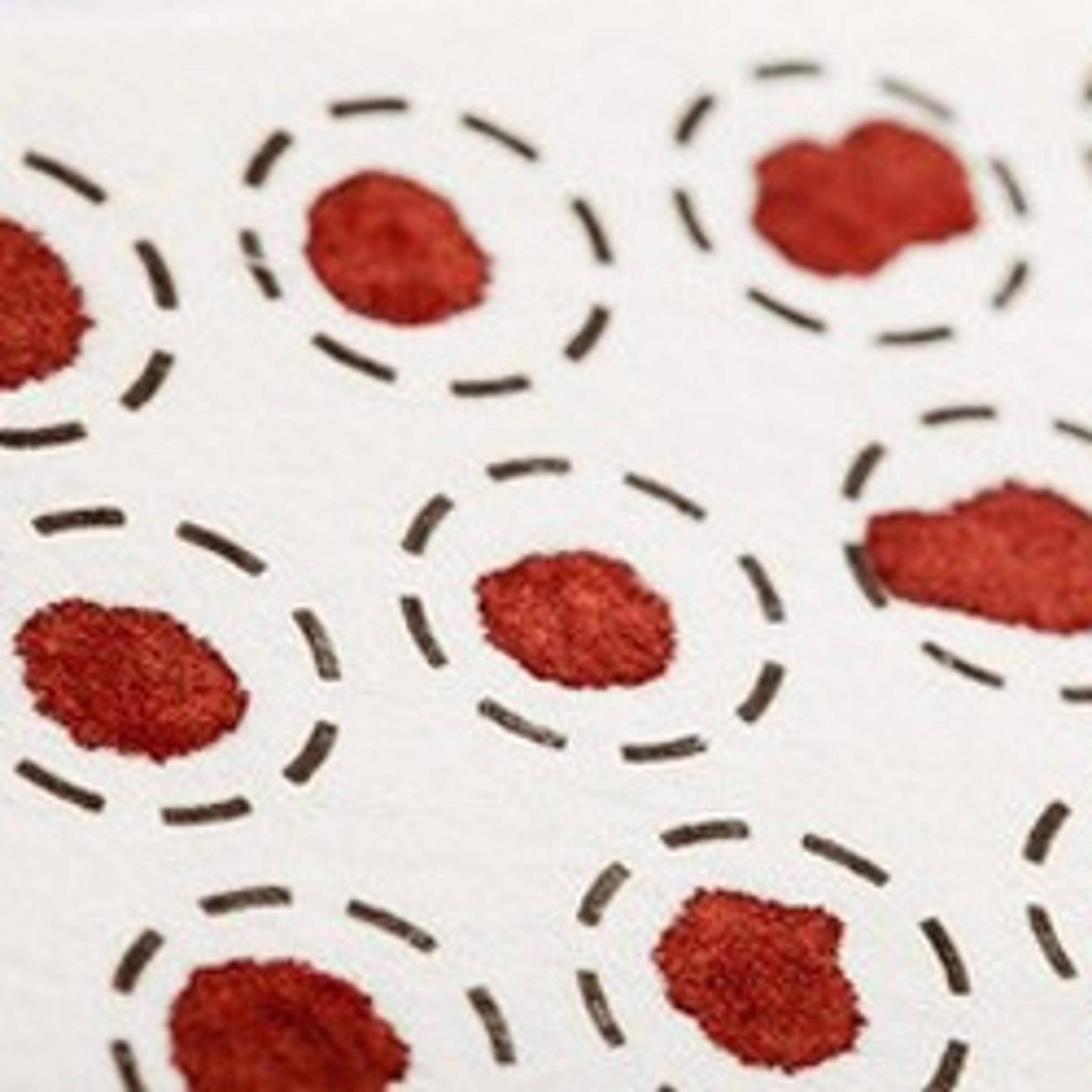 Dried Blood Spot Analysis - CFP-DBS-v1 - I.W. Tremont - Clinical Diagnostics