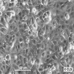 CaSki - Cell Lines Service GmbH - Life Sciences