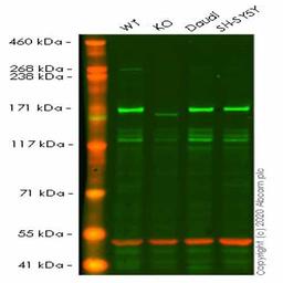 Human EEA1 knockout HeLa cell line - Abcam plc - Life Sciences
