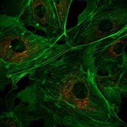 LaserBank - Cairn Research Ltd - Spectroscopy