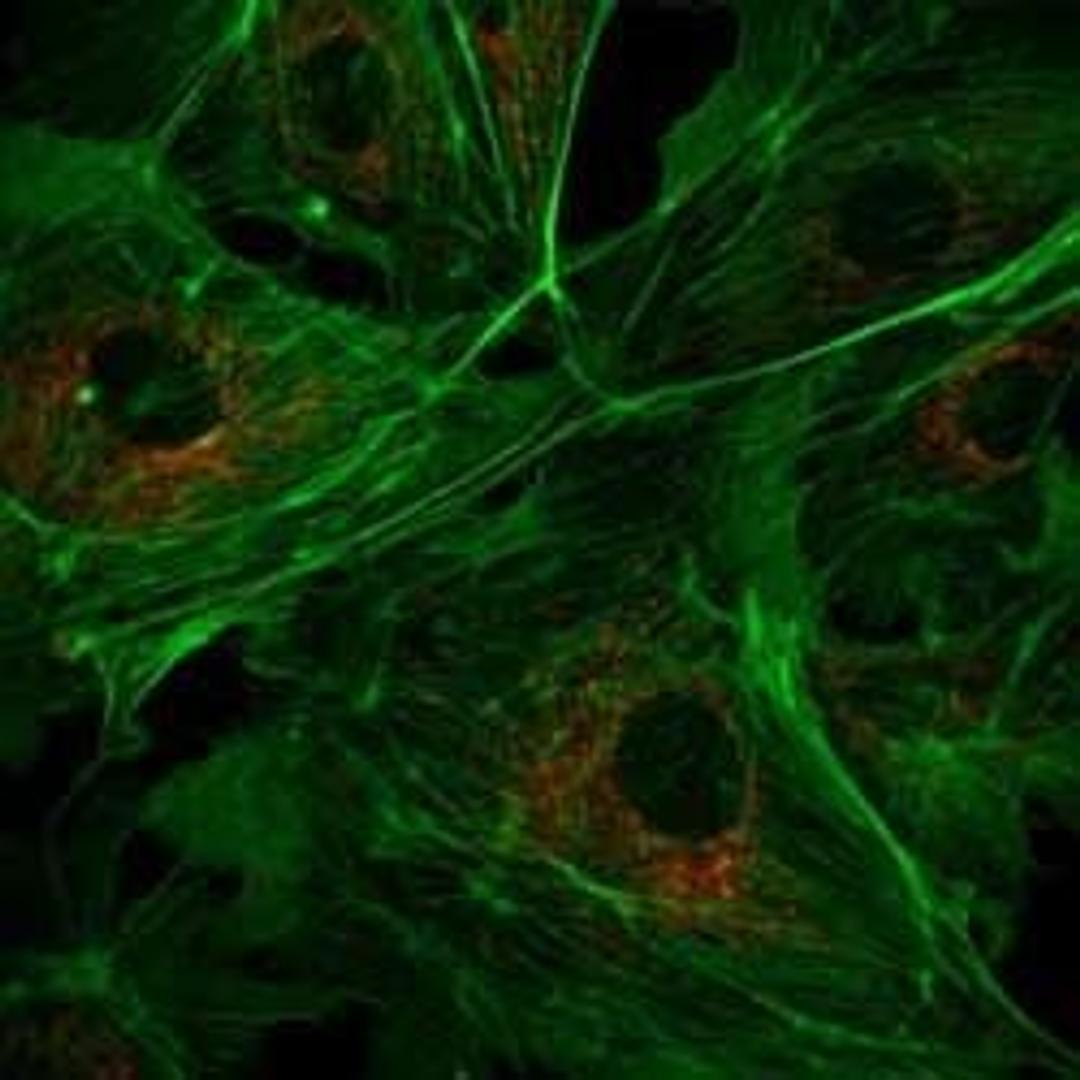 LaserBank - Cairn Research Ltd - Spectroscopy