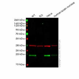 Human PARK7 (DJ1) knockout HEK293T cell line - Abcam plc - Life Sciences