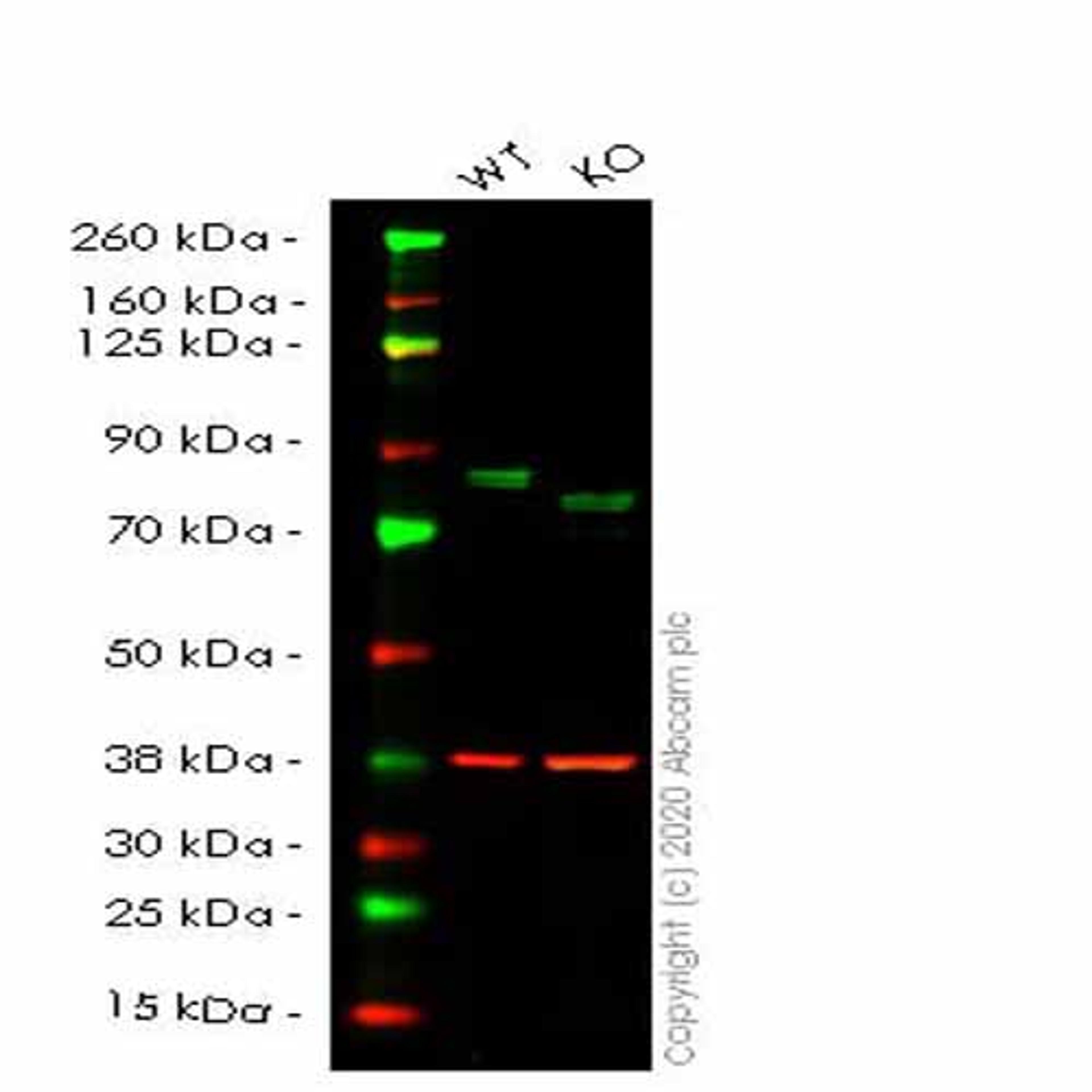 Human WHSC1 (NSD2) knockout HeLa cell line - Abcam plc - Life Sciences