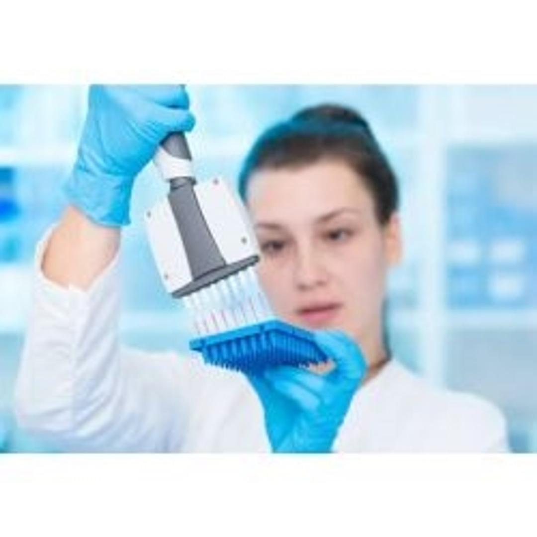 Pipette calibration services - Integrated Instrument Services - Lab Informatics