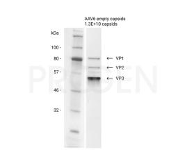 AAV6 empty capsids - PROGEN - Life Sciences