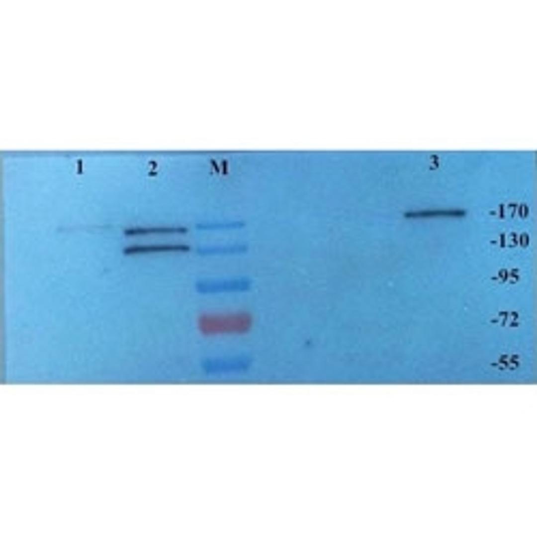 CD206 antibody - Biorbyt - Life Sciences