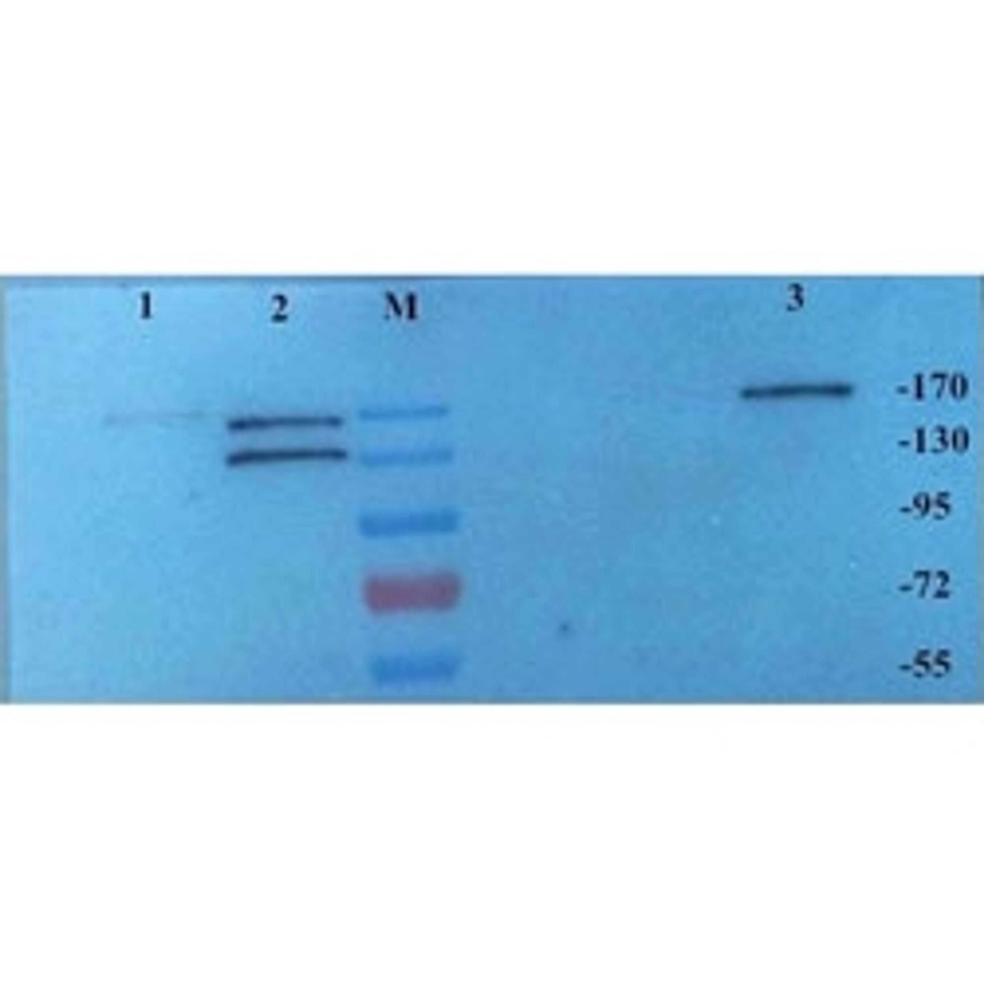 CD206 antibody - Biorbyt - Life Sciences
