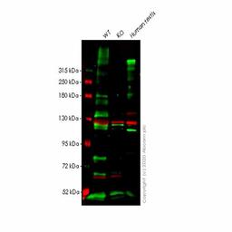 Human LAMA1 (LAMA) knockout HeLa cell line - Abcam plc - Life Sciences