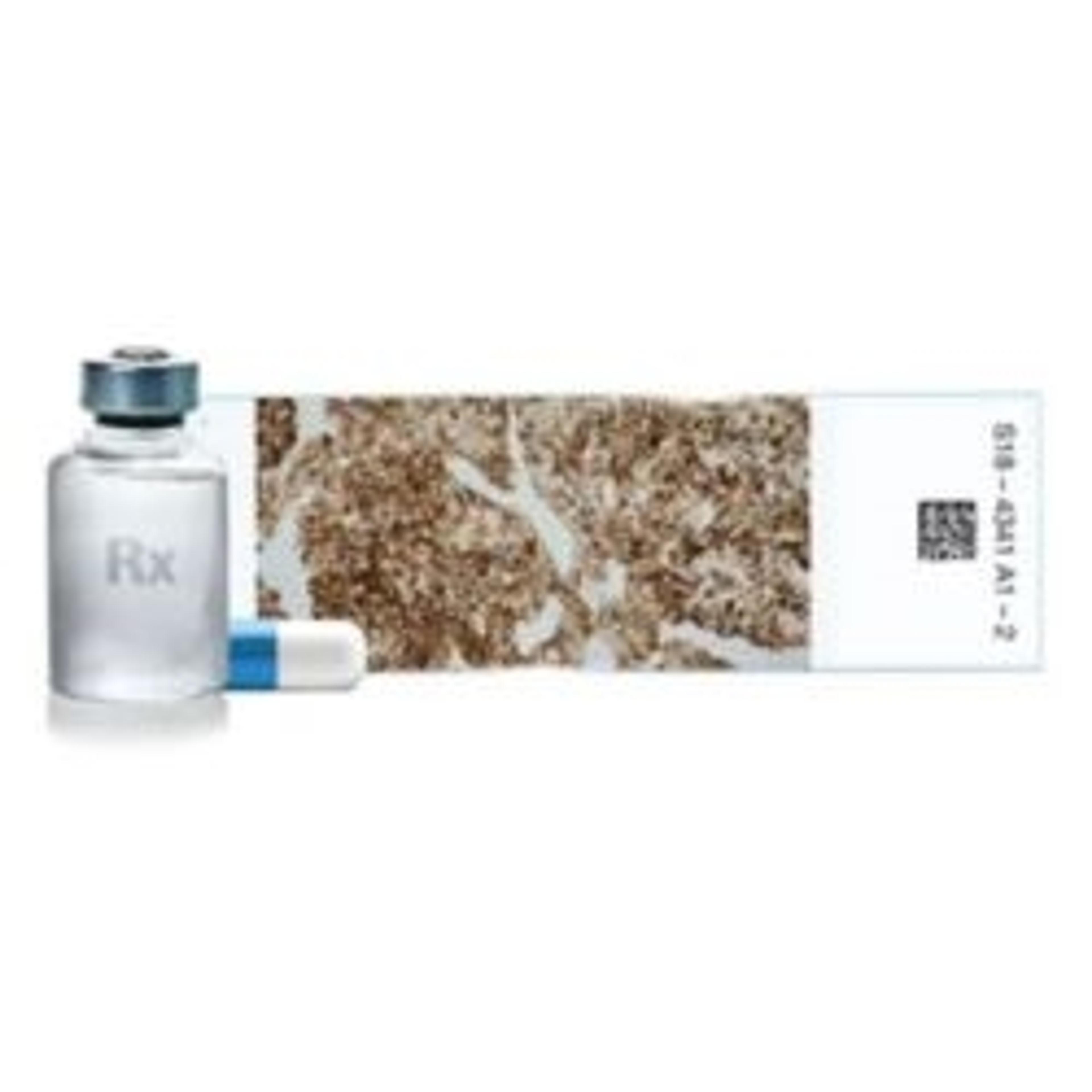 VENTANA FOLR1 (FOLR1-2.1) RxDx Assay - Roche - Life Sciences