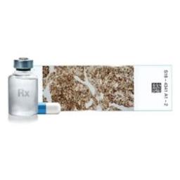 VENTANA FOLR1 (FOLR1-2.1) RxDx Assay - Roche - Life Sciences