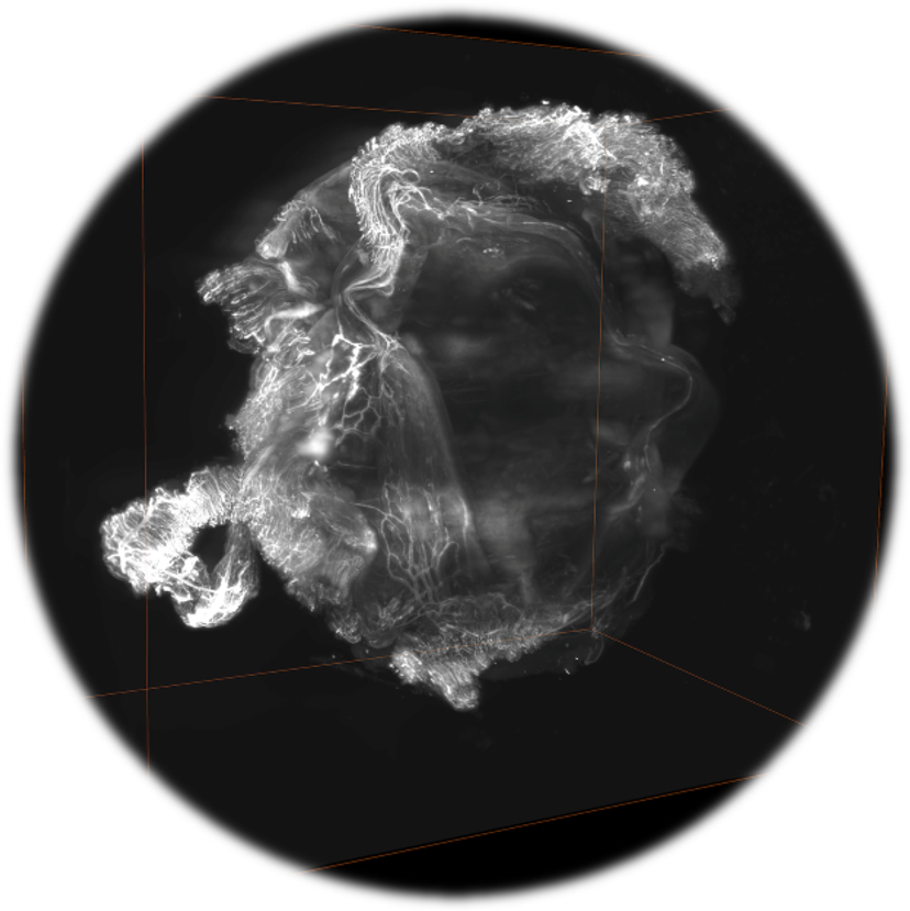 Intact entire eye vasculature after tissue clearing with the X-CLARITY