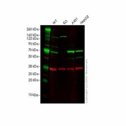Human ACADVL (VLCAD) knockout HEK293T cell line - Abcam plc - Life Sciences