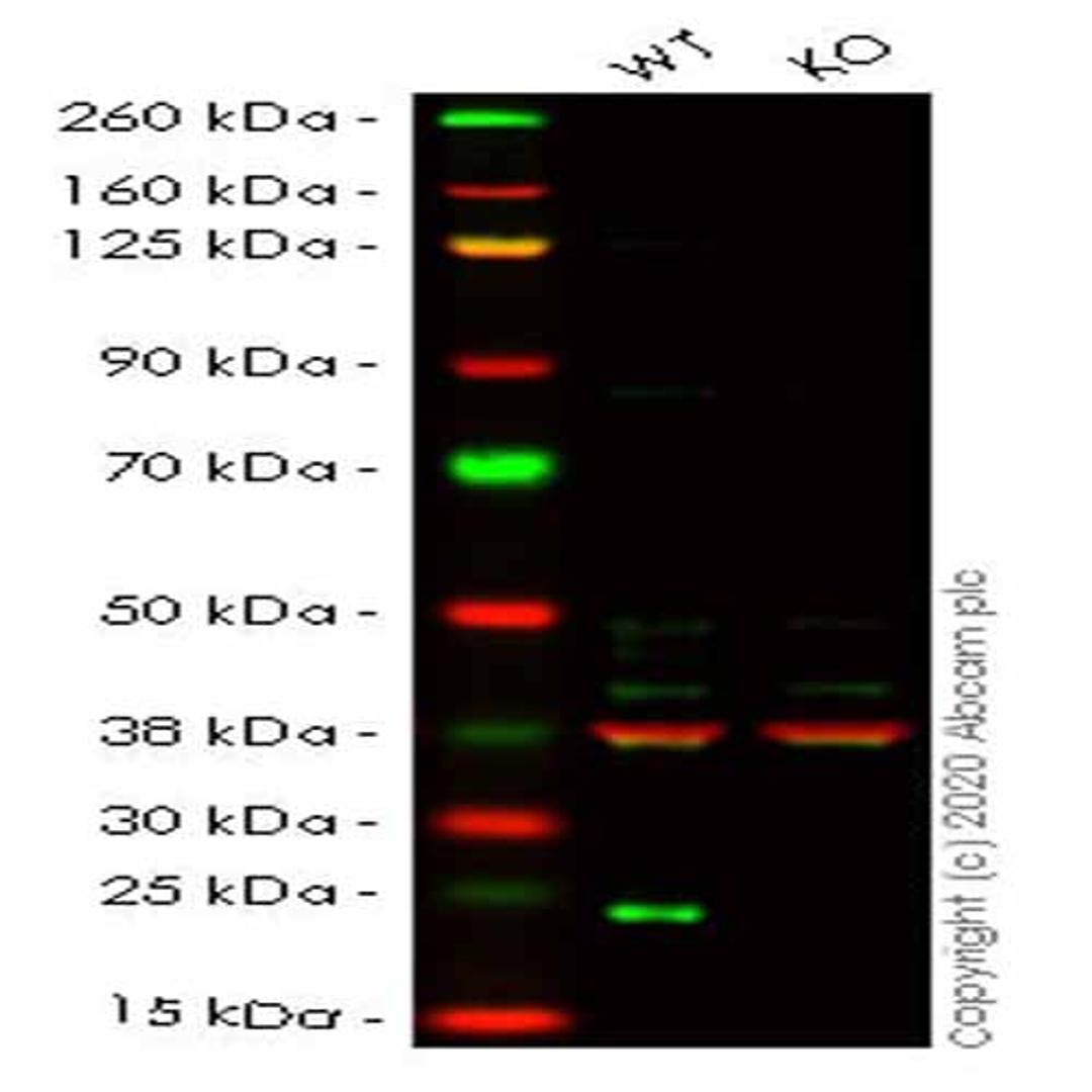 Human LYPLA1 (Lysophospholipase 1/LPL-I) knockout HEK293T cell line - Abcam plc - Life Sciences