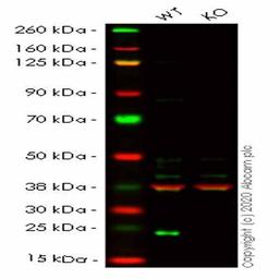 Human LYPLA1 (Lysophospholipase 1/LPL-I) knockout HEK293T cell line - Abcam plc - Life Sciences