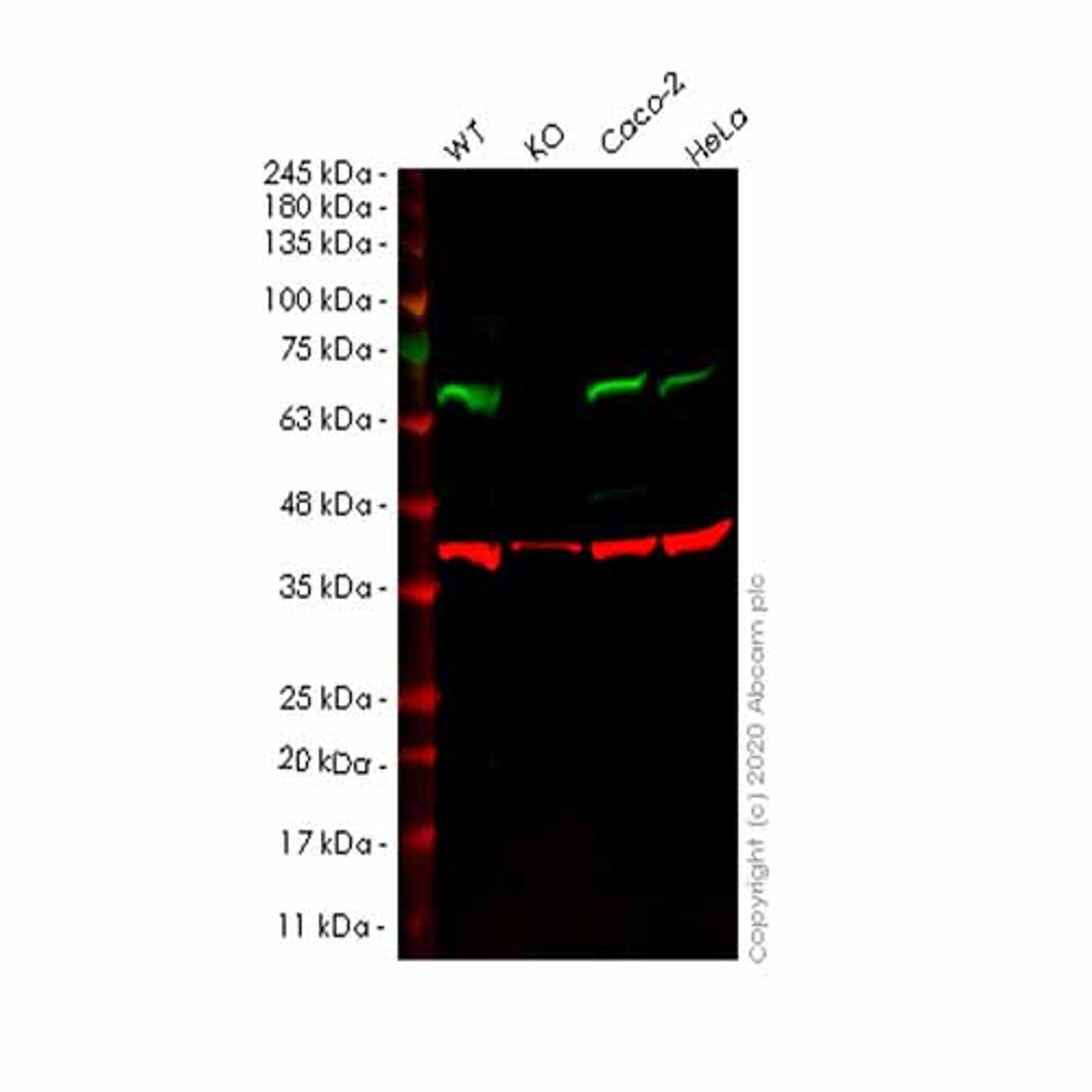 Human PPP2R1B knockout HEK293T cell line - Abcam plc - Life Sciences