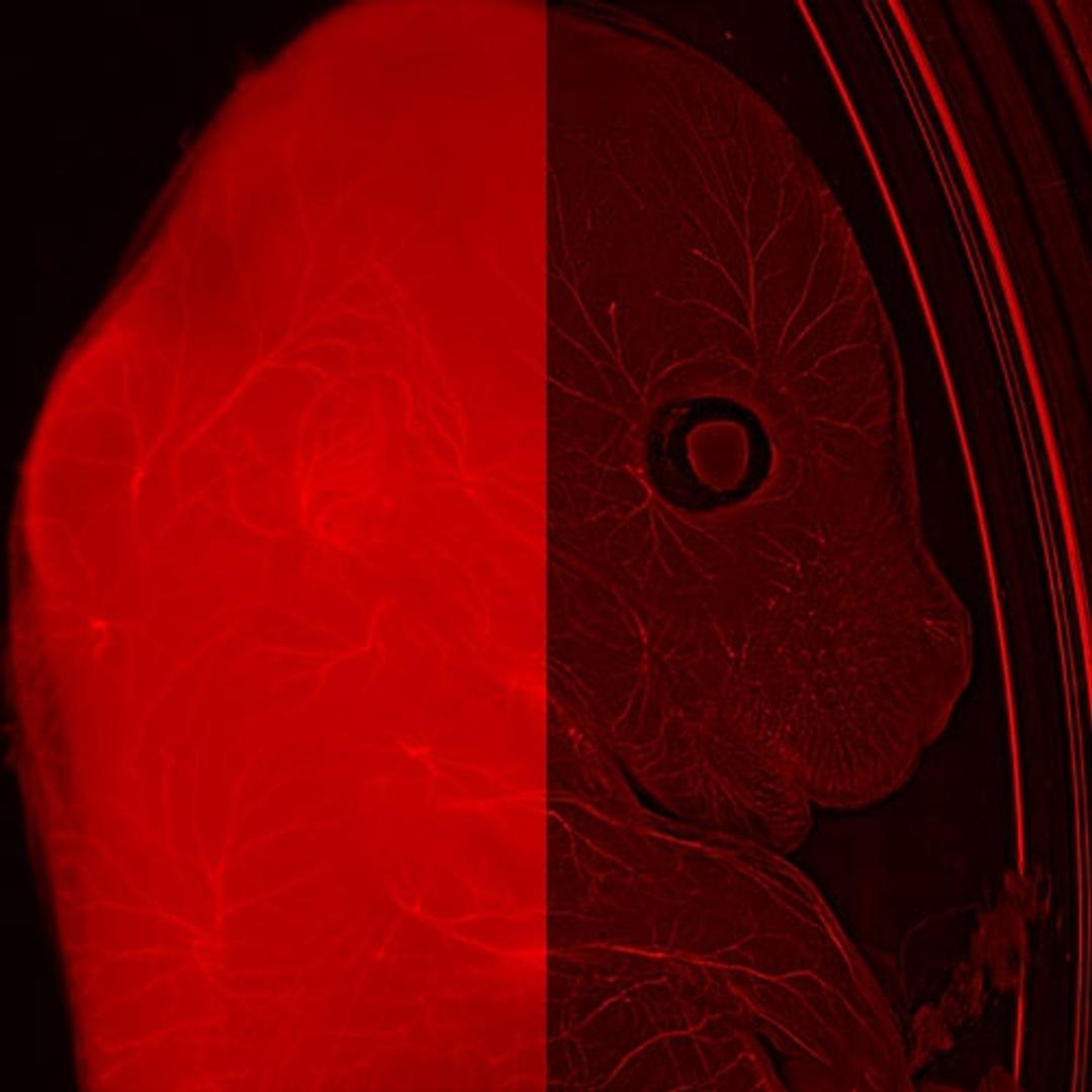 Courtesy Yves Lutz, IGBMC (FR)