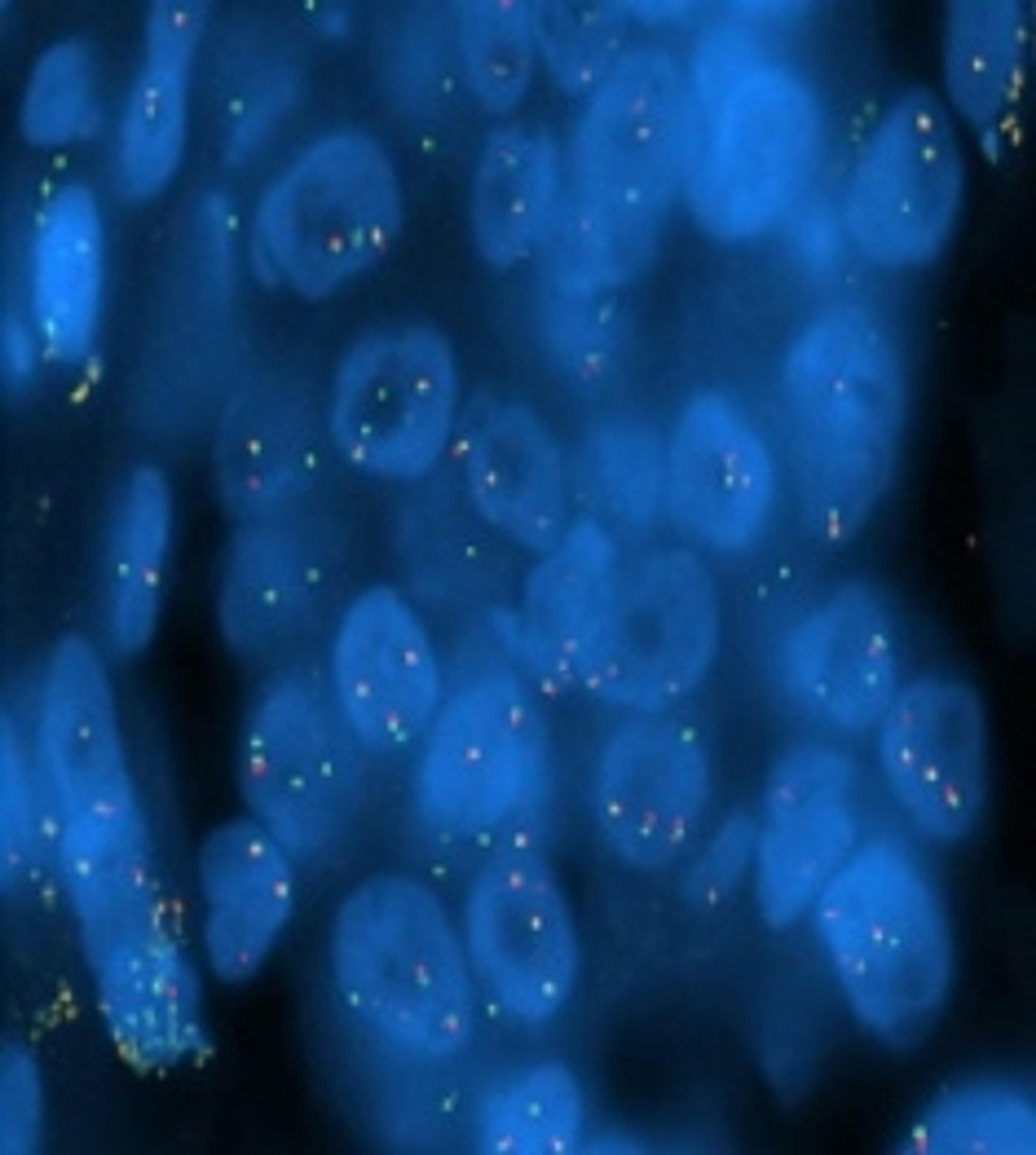 IQFISH Panel for Lung Cancer - Agilent Technologies - Life Sciences