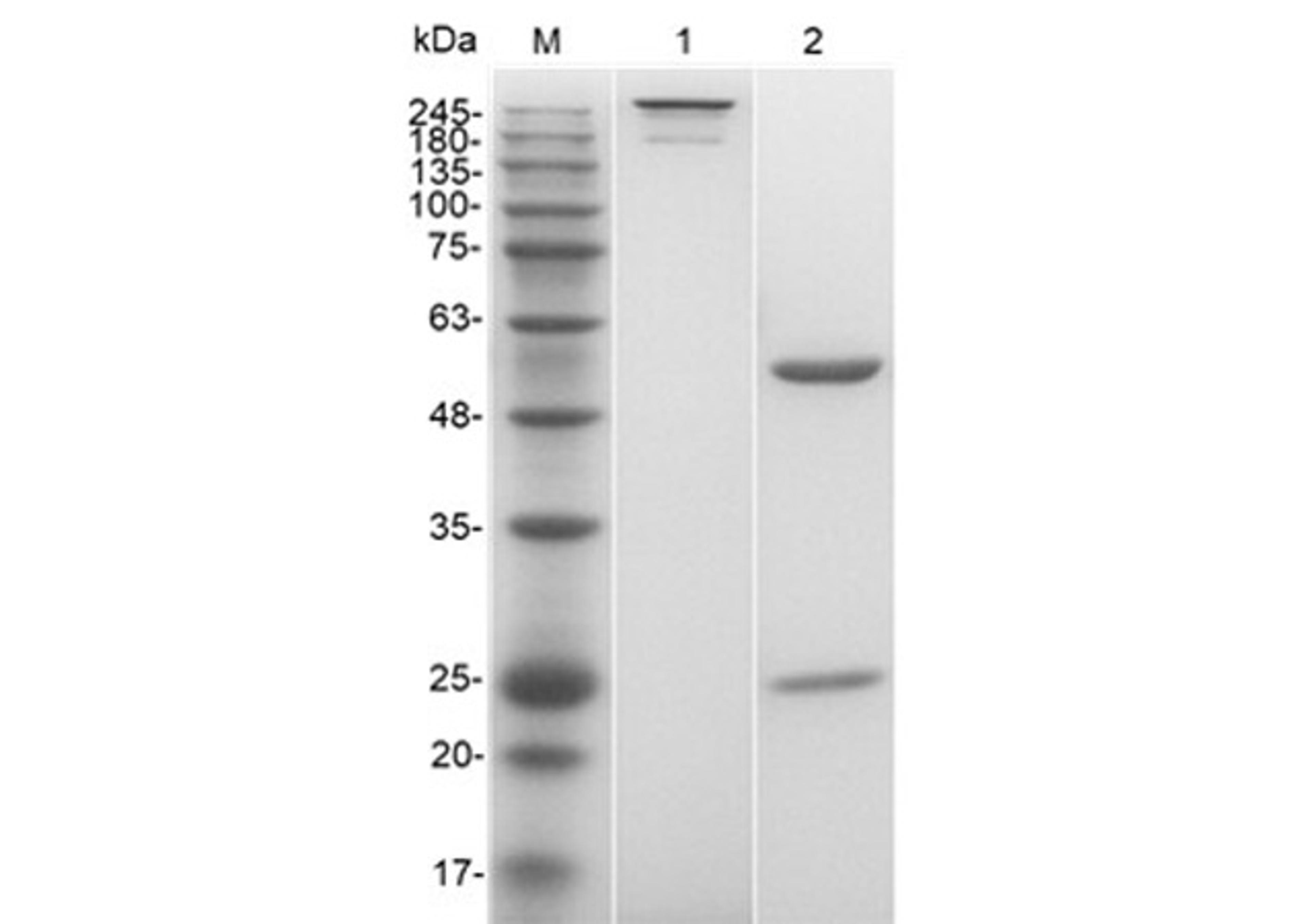 Human Anti-TSHR Recombinant Antibody (clone K1-70)