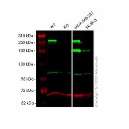 Human MYOF (Myoferlin) knockout HeLa cell line - Abcam plc - Life Sciences