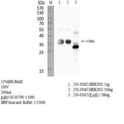 Rabbit anti-SARS-CoV-2 S1 RBD antibody - RayBiotech Inc. - Life Sciences