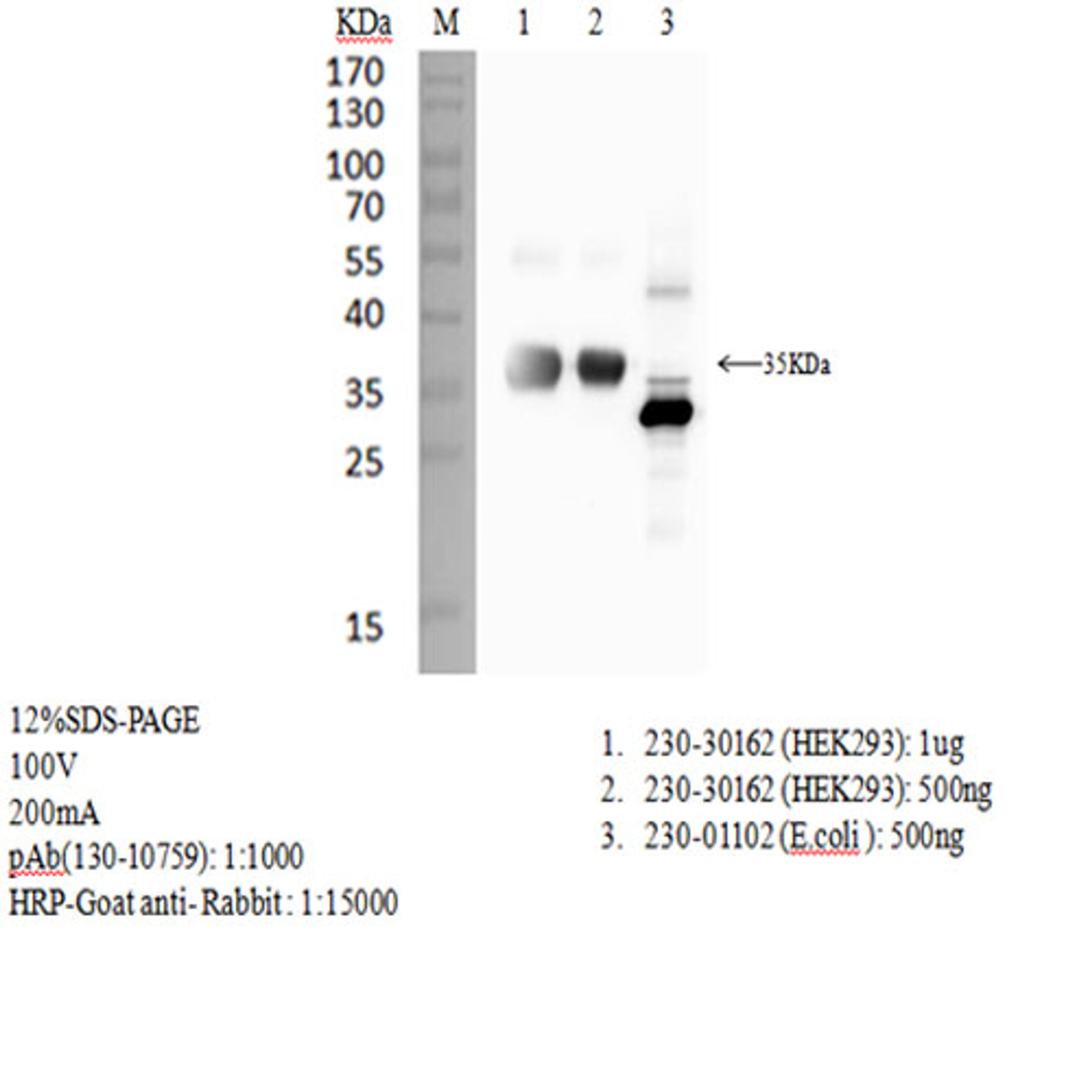 Rabbit anti-SARS-CoV-2 S1 RBD antibody - RayBiotech Inc. - Life Sciences