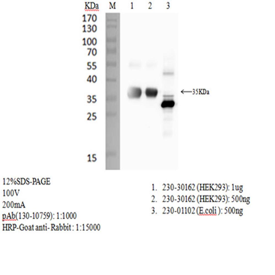 Rabbit anti-SARS-CoV-2 S1 RBD antibody - RayBiotech Inc. - Life Sciences