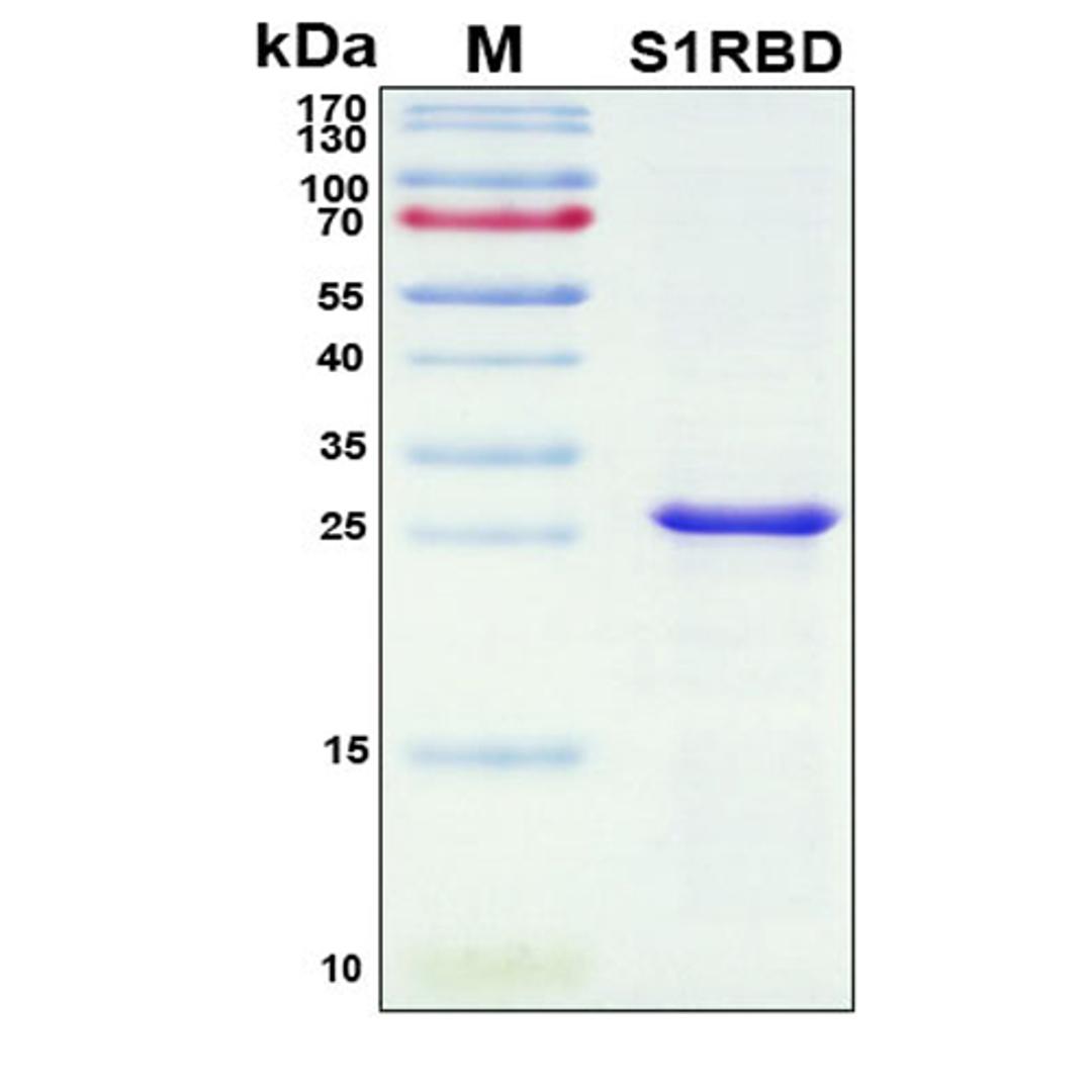 Recombinant SARS-CoV-2 Spike Protein, S1 Subunit, Host Cell Receptor Binding Domain (RBD) - RayBiotech Inc. - Life Sciences