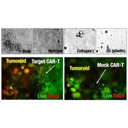 Reconstructed Bone (r-Bone™) 3D Cell Culture Service, Mulitiple Myeloma - zPREDICTA - Life Sciences