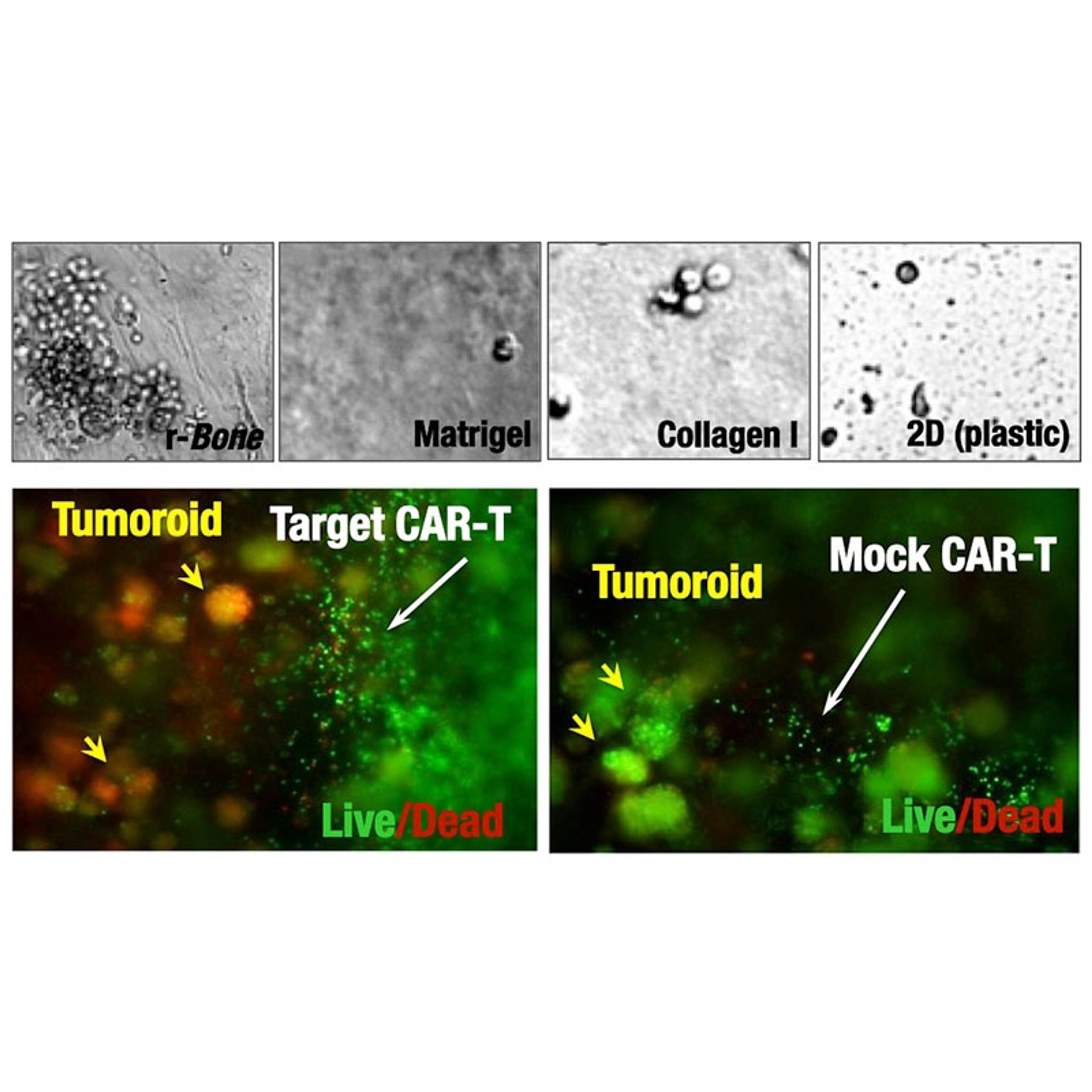 Reconstructed Bone (r-Bone™) 3D Cell Culture Service, Mulitiple Myeloma - zPREDICTA - Life Sciences
