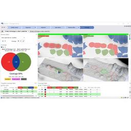 Melanie 9 Classic and DIGE Software - Cytiva - Life Sciences