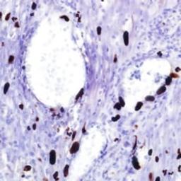 CMV (8B1.2, 1G5.2 & 2D4.2) - Merck - Life Sciences