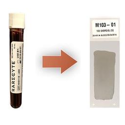 AccuCyte Sample Preparation System - RareCyte, Inc - Life Sciences