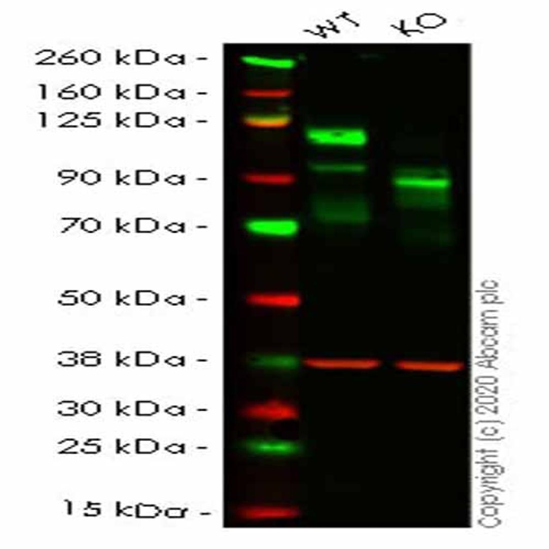 Human MCAM (CD146) knockout HeLa cell line - Abcam plc - Life Sciences