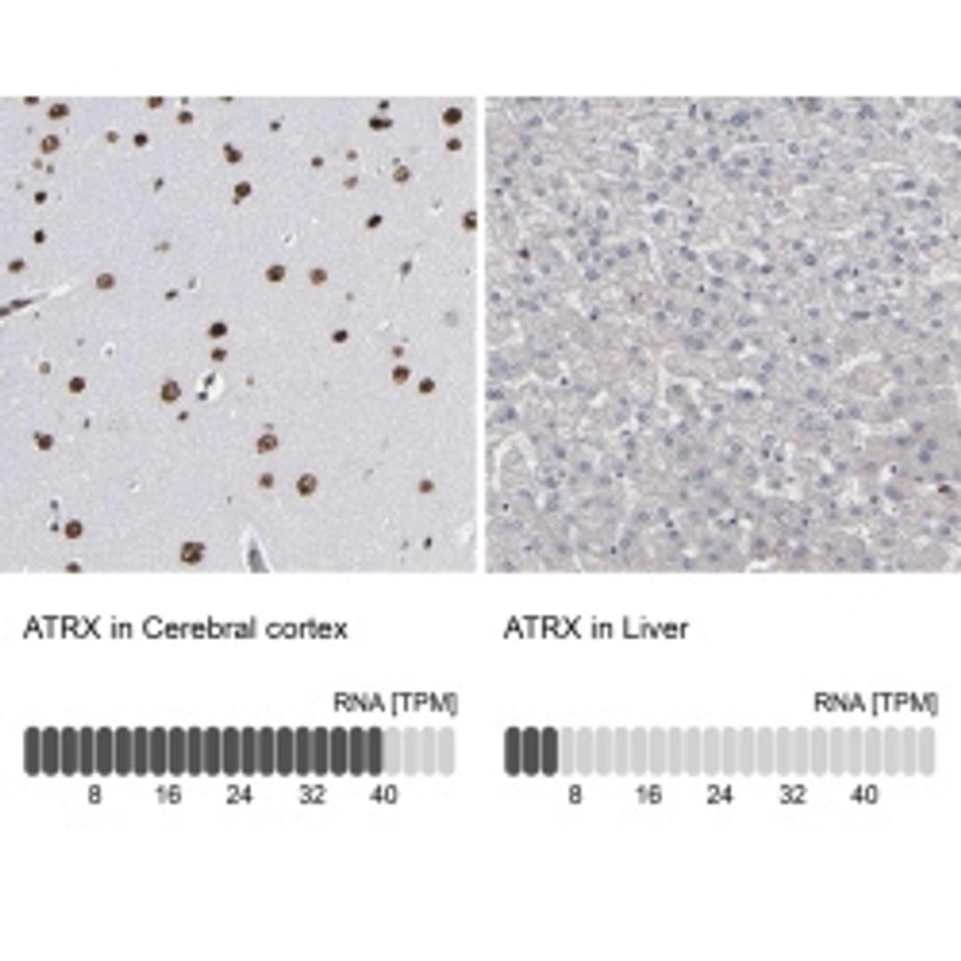 Anti-ATRX antibody produced in rabbit - Merck KGaA, Darmstadt, Germany - Life Sciences