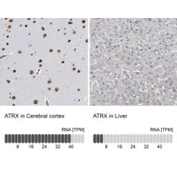 Anti-ATRX antibody produced in rabbit - Merck KGaA, Darmstadt, Germany - Life Sciences