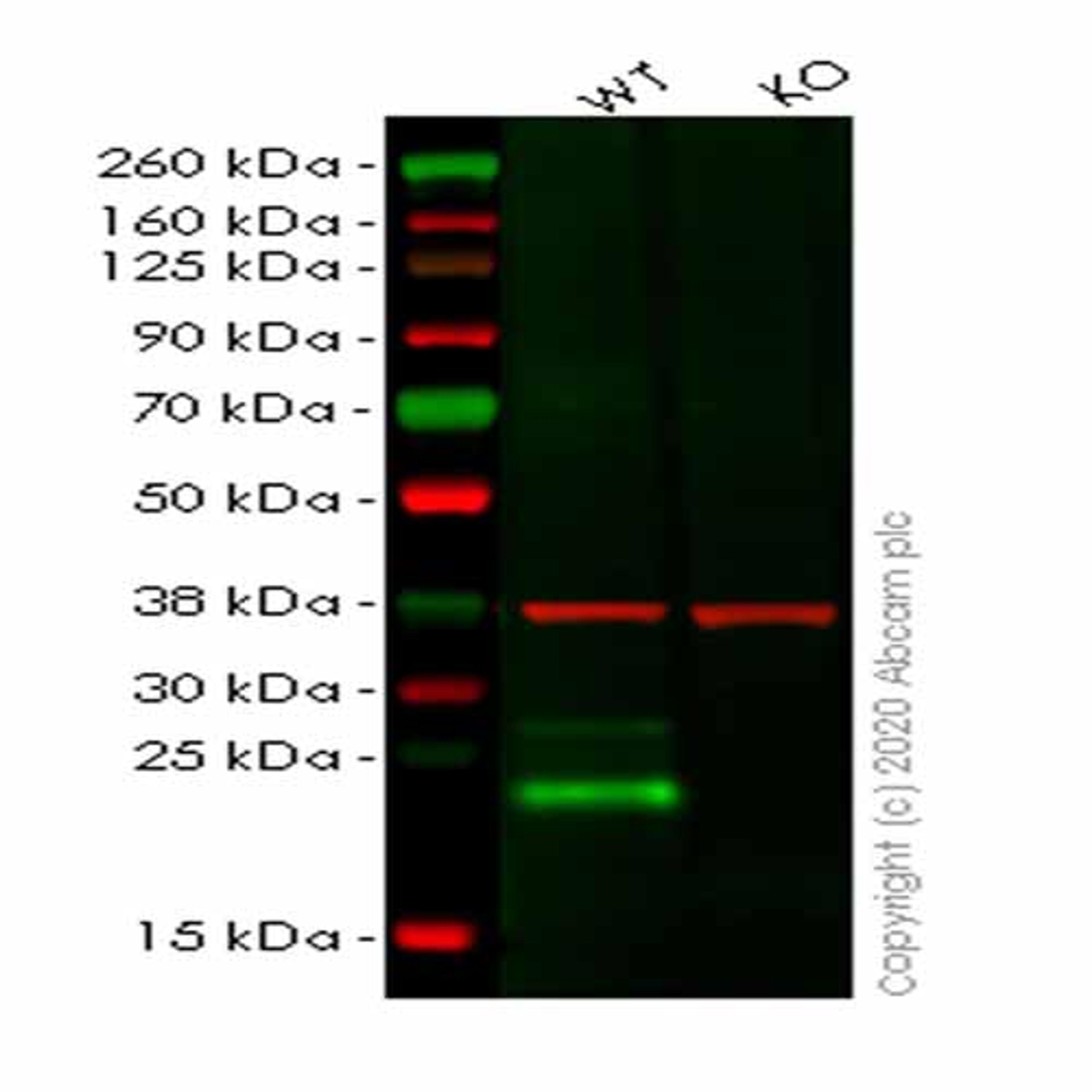 Human LY6K (Ly-6K) knockout HeLa cell line - Abcam plc - Life Sciences