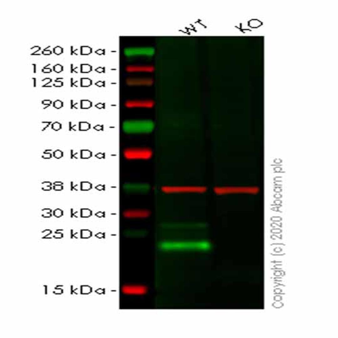 Human LY6K (Ly-6K) knockout HeLa cell line - Abcam plc - Life Sciences