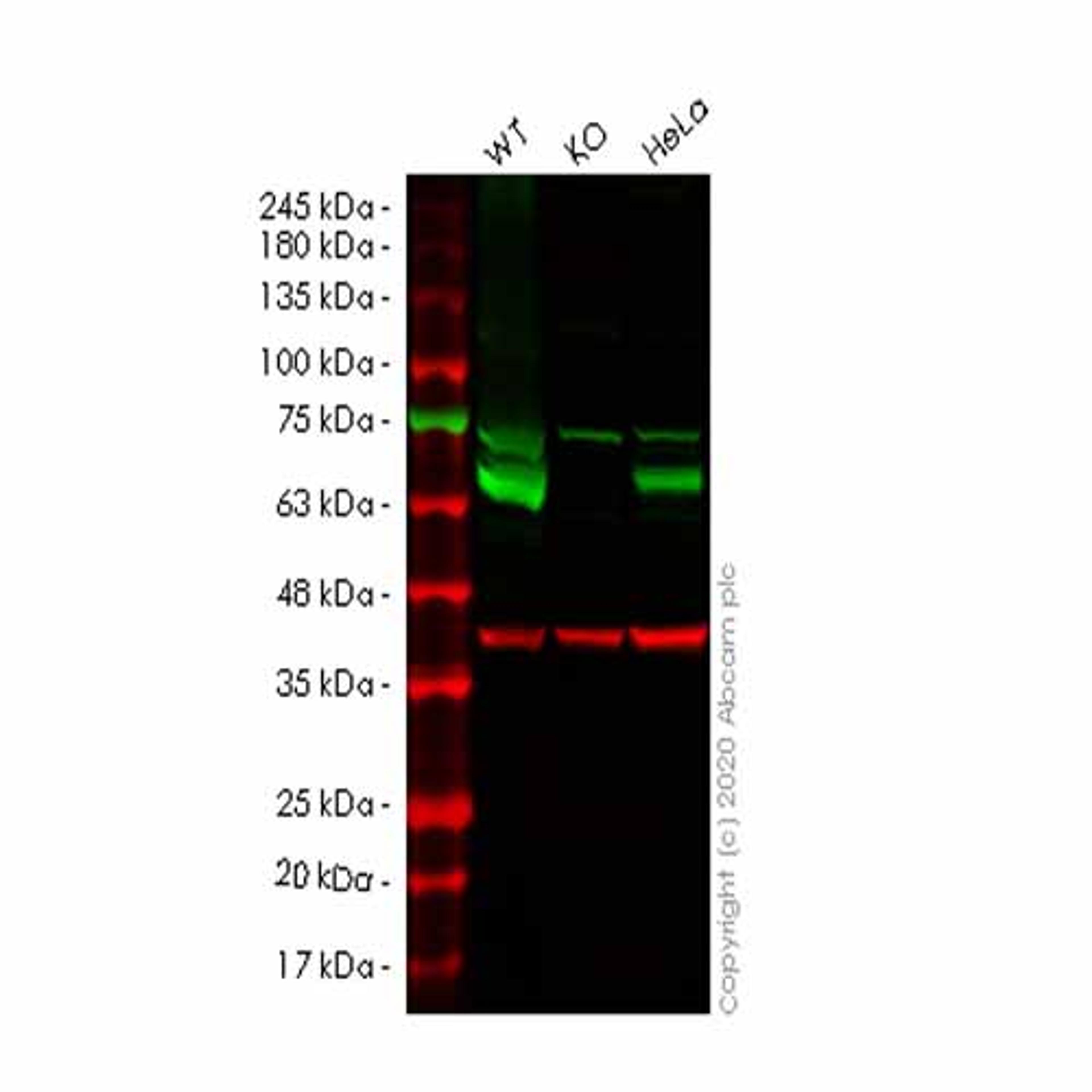 Human CARM1 knockout HEK293T cell line - Abcam plc - Life Sciences