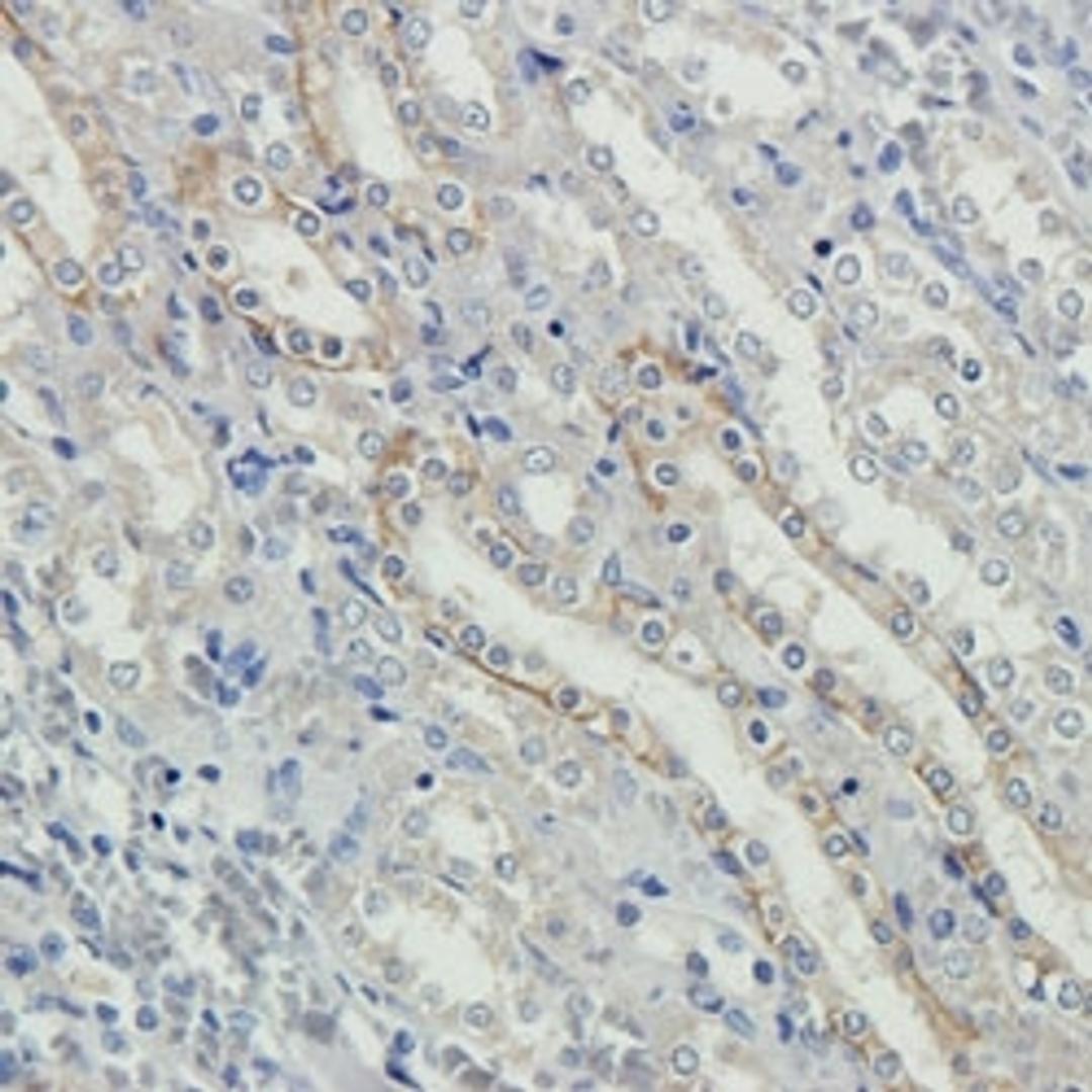 NKp46 antibody - Biorbyt - Life Sciences
