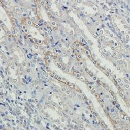 NKp46 antibody - Biorbyt - Life Sciences