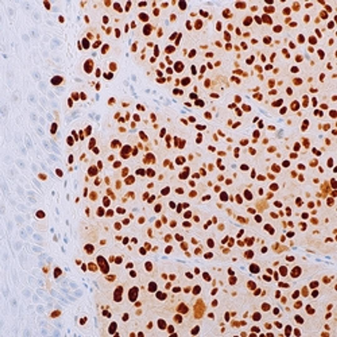 PRAME (EP461) Rabbit Monoclonal Primary Antibody - Merck - Life Sciences