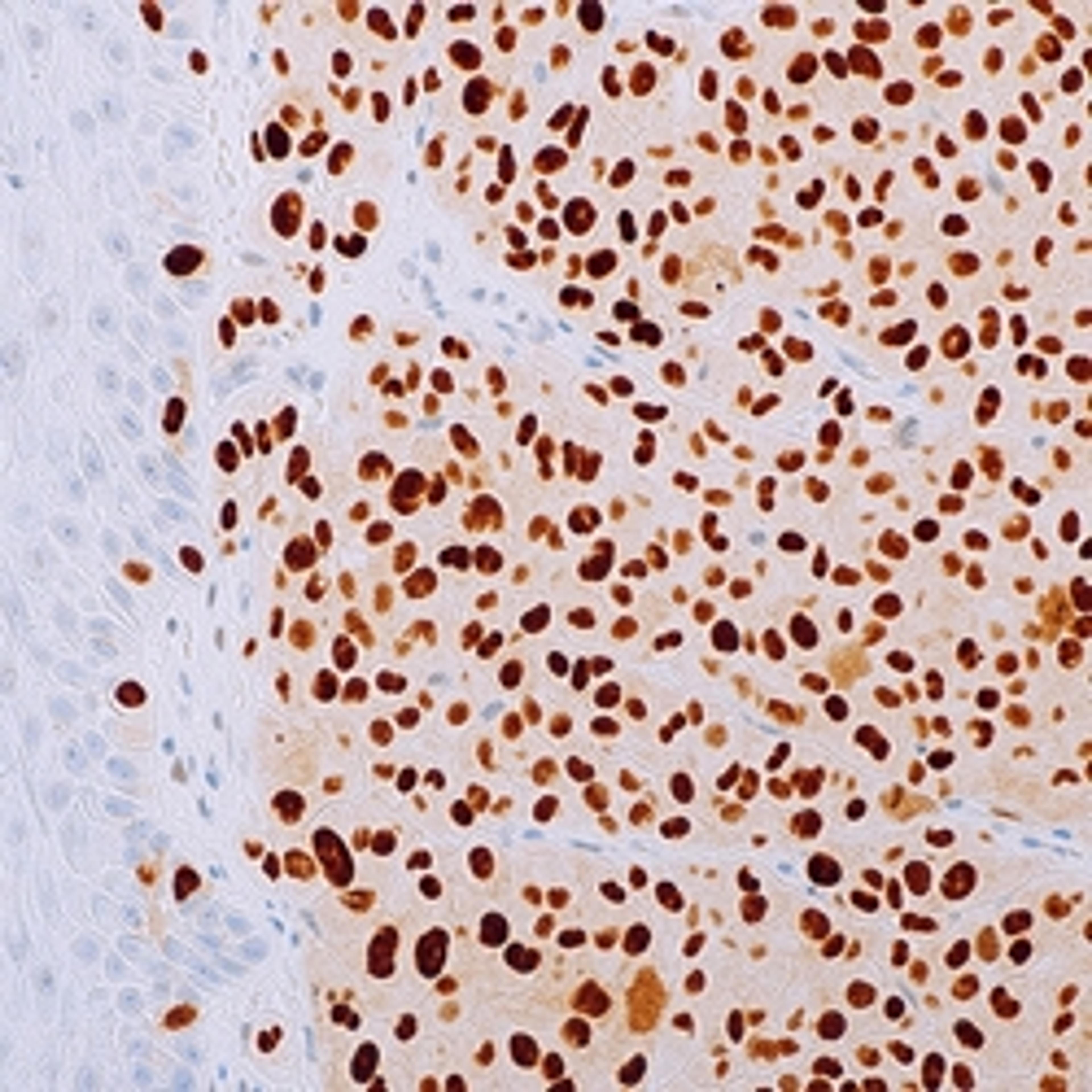 PRAME (EP461) Rabbit Monoclonal Primary Antibody - Merck - Life Sciences